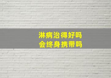 淋病治得好吗 会终身携带吗